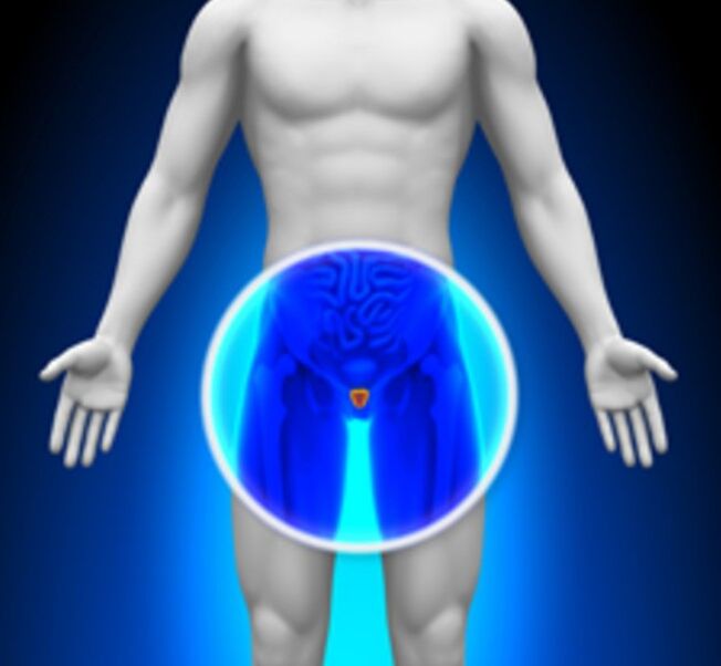 Prostatitis