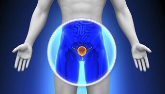 Prostatitisaren tratamendua drogekin