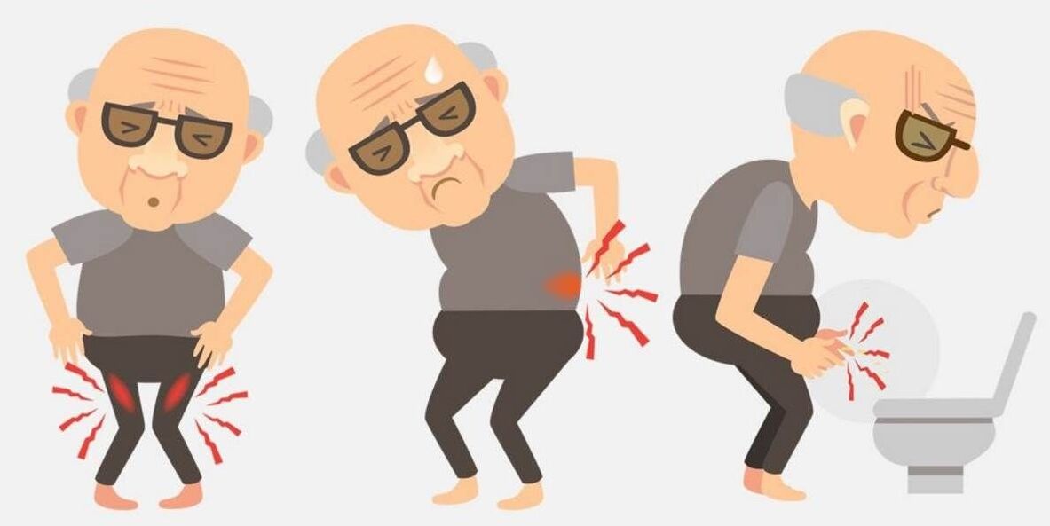 prostatitisaren sintomak